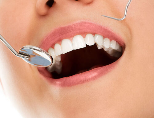 Picture perfect teeth- Hurry In!